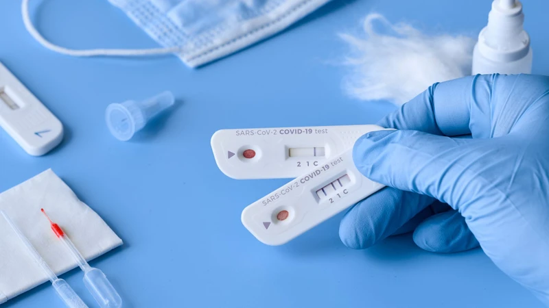 Xét nghiệm COVID ở đâu? Các phương pháp xét nghiệm COVID hiện nay 2