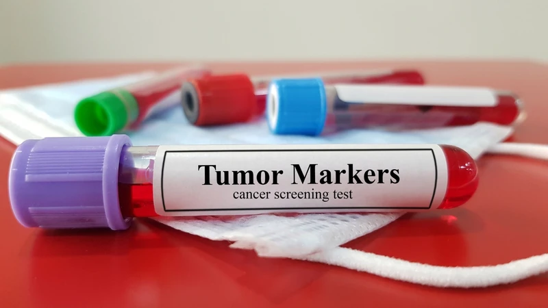 Ở giai đoạn sớm của ung thư, nồng độ marker có thể không tăng đủ để phát hiện, gây âm tính giả