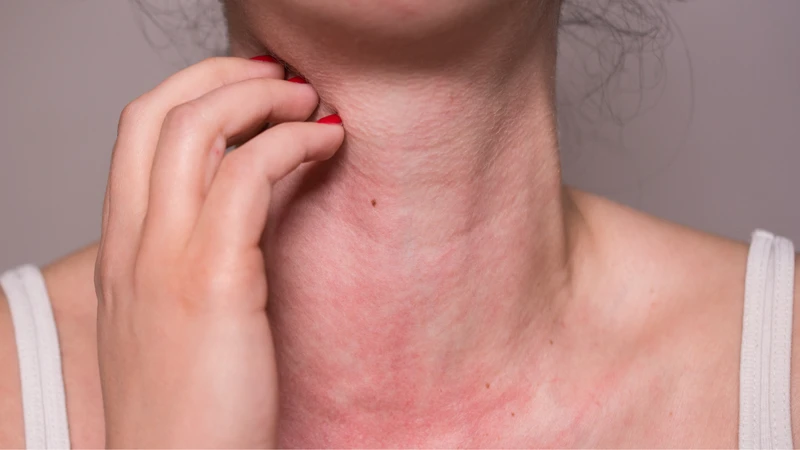 Xét nghiệm dị nguyên là gì? Khi nào cần thực hiện xét nghiệm dị nguyên? 1