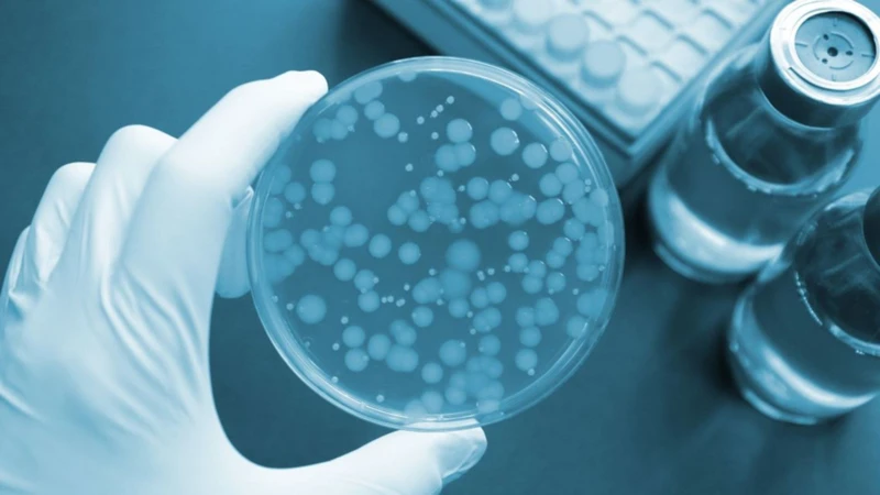 Xét nghiệm dịch não tủy có thể được chỉ định trong chẩn đoán nhiễm nấm Cryptococcus