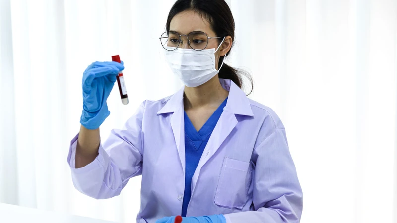 Kết quả CA 19-9 không đủ giá trị để chẩn đoán xác định ung thư