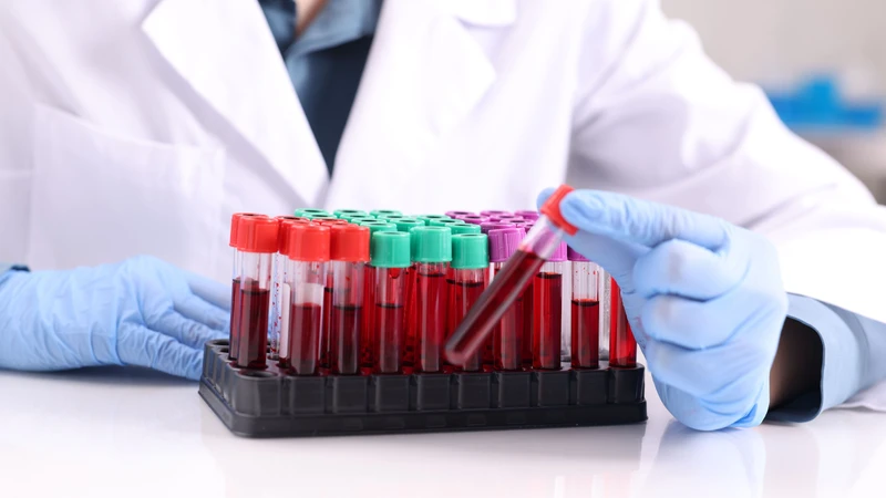 Tải lượng virus viêm gan C được chia thành mức thấp và mức cao dựa trên ngưỡng 800.000 IU/mL