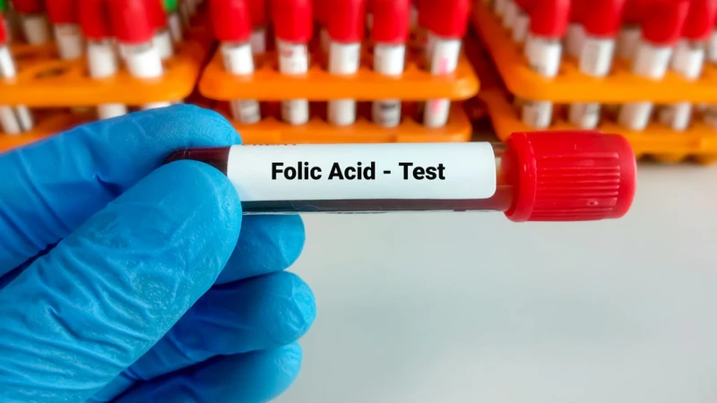 Xét nghiệm folate có thể được chỉ định khi xuất hiện dấu hiệu thiếu máu hoặc có nguy cơ thiếu vitamin B9