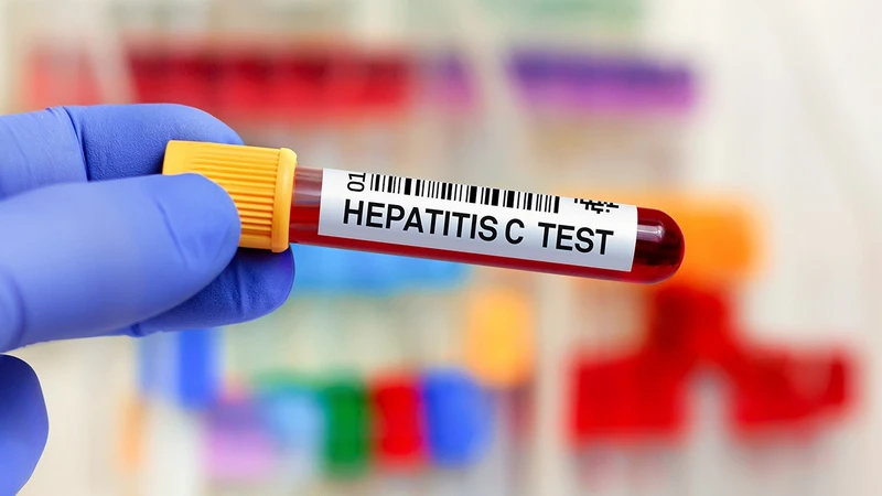 Kết quả xét nghiệm HCV RNA thường có trong vòng 1 - 2 ngày