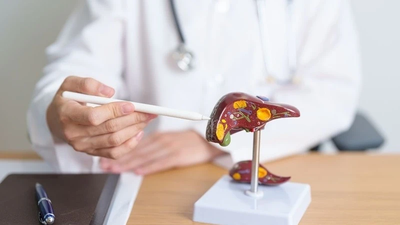 Quy trình xét nghiệm HCV ARN gồm 4 bước chính