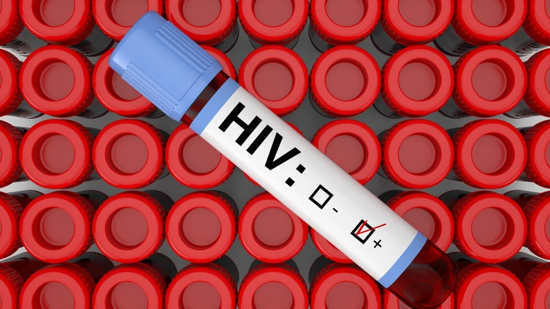Xét nghiệm HIV sau 4 tháng có chính xác không? Khi nào nên làm lại xét nghiệm?