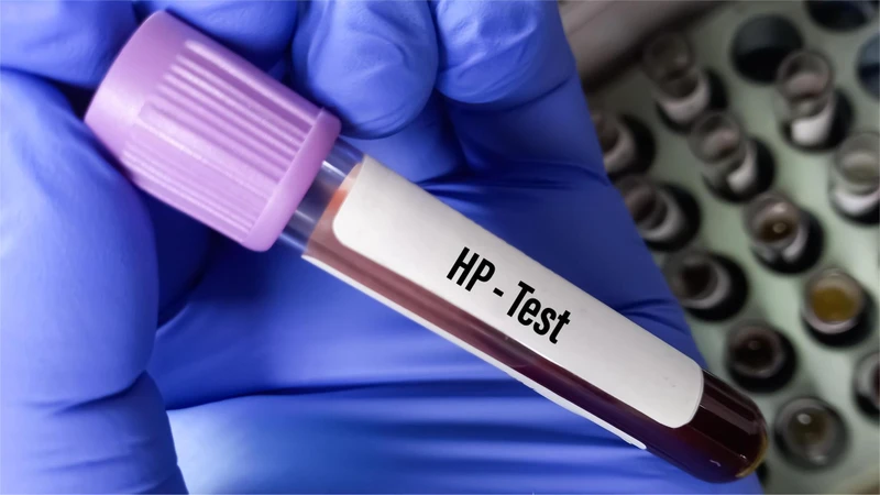 Xét nghiệm HP là gì? Các phương pháp xét nghiệm HP và những điều cần biết 1