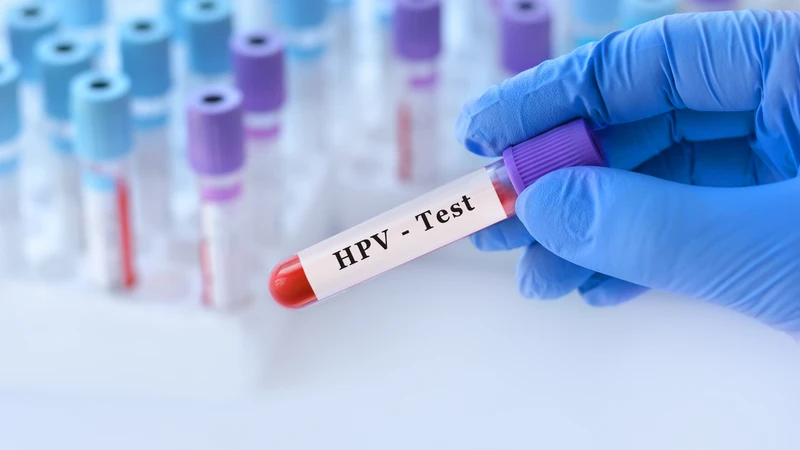 xet-nghiem-hpv-bao-lau-co-ket-qua-va-nhung-dieu-can-luu-y-khi-xet-nghiem-hpv 3.png