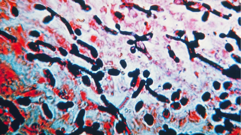 Nấm Candida là một loại nấm men phổ biến, thường trú tự nhiên trong cơ thể con người