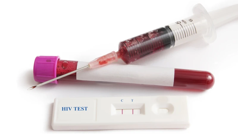 Xét nghiệm nhanh HIV là phương pháp sàng lọc ban đầu