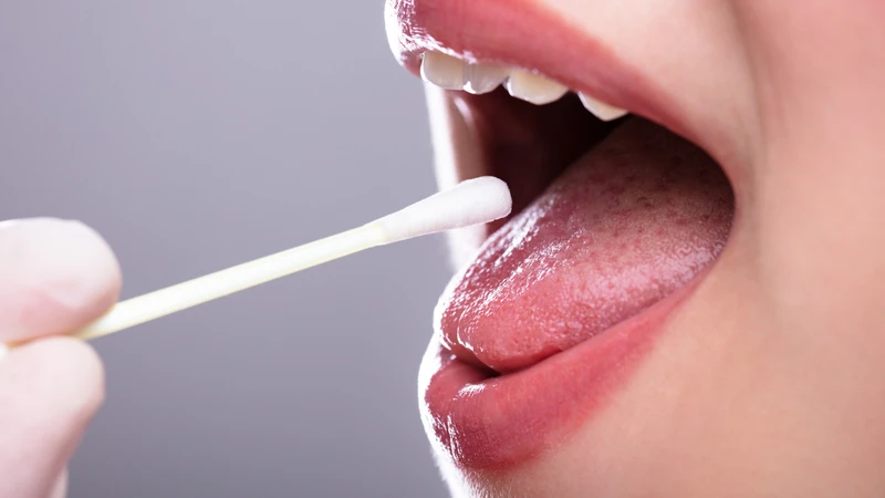 Có thể xác định nhóm máu ABO thông qua xét nghiệm nước bọt