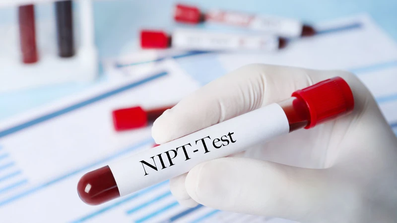 Kết quả xét nghiệm NIPT bất thường có thể là dấu hiệu cần được đánh giá thêm