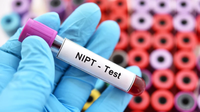 Những thay đổi bất thường trong DNA lưu hành của người mẹ có thể tạo ra kết quả NIPT bất thường