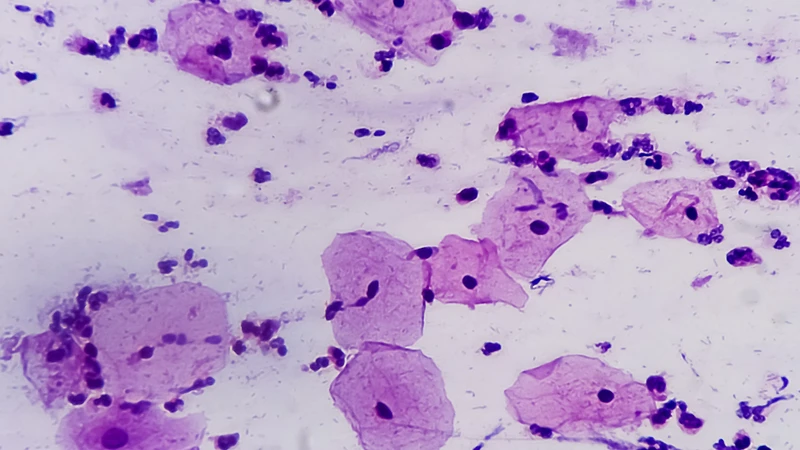 xet-nghiem-pap-va-hpv-bao-nhieu-tien-su-khac-biet-giua-xet-nghiem-pap-va-hpv 2.png