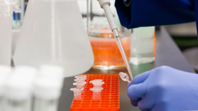 Xét nghiệm PCR là gì? Ứng dụng của xét nghiệm PCR trong bệnh truyền nhiễm 1