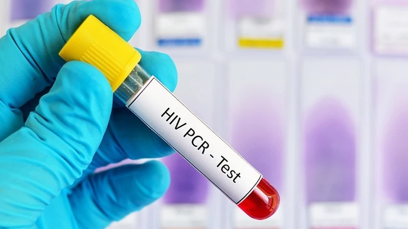 Xét nghiệm RT-PCR là gì? Những ai cần thực hiện xét nghiệm? 2