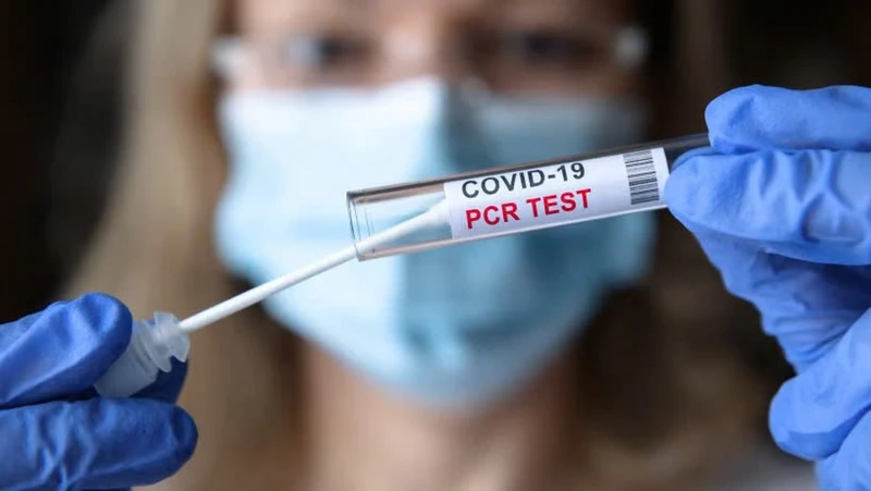Xét nghiệm RT-PCR là gì? Những ai cần thực hiện xét nghiệm? 3