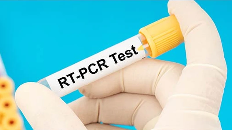 Xét nghiệm RT-PCR là gì? Những ai cần thực hiện xét nghiệm? 6
