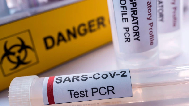 Xét nghiệm RT-PCR có nhiều ưu điểm hơn so với các kỹ thuật xét nghiệm thông thường