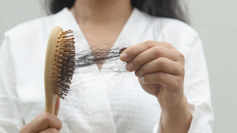 Một số xét nghiệm giúp đánh giá nguyên nhân gây rụng tóc