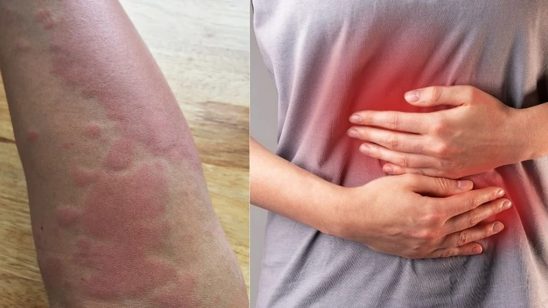 Xét nghiệm sán chó bao lâu có kết quả? Lưu ý gì khi thực hiện? 3