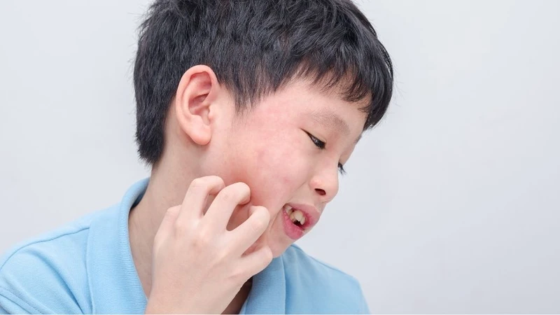 Xét nghiệm sán chó bao nhiêu tiền? Phòng bệnh ra sao? 2