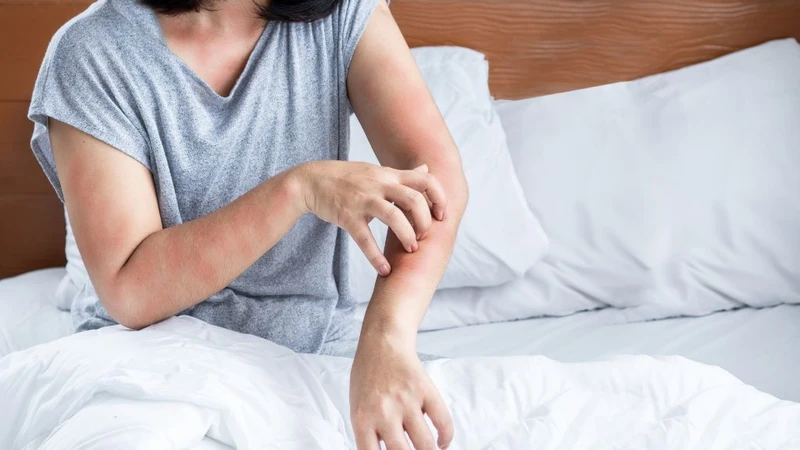 Xét nghiệm sán chó có cần nhịn ăn không? 2