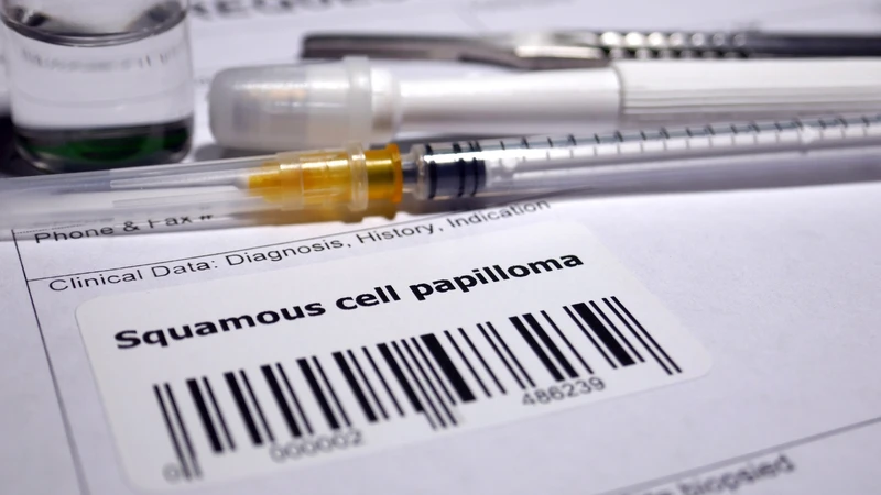 Xét nghiệm SCC (Squamous Cell Carcinoma antigen) là xét nghiệm máu nhằm đo nồng độ kháng nguyên liên quan đến ung thư tế bào vảy