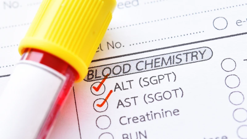 Xét nghiệm sinh hóa máu: Những thông tin quan trọng cần biết 2