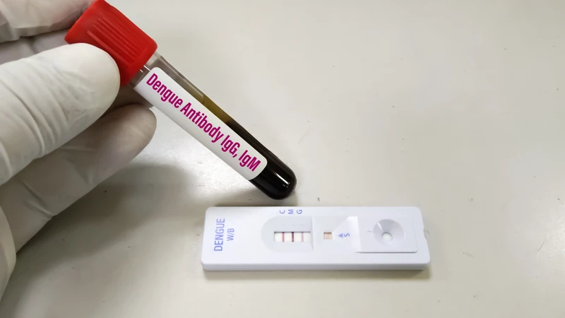 Xét nghiệm sốt xuất huyết như thế nào? Những lưu ý cần biết