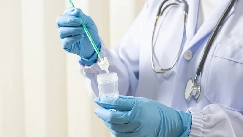 Xét nghiệm sùi mào gà ở nam: Những thông tin quan trọng cần biết