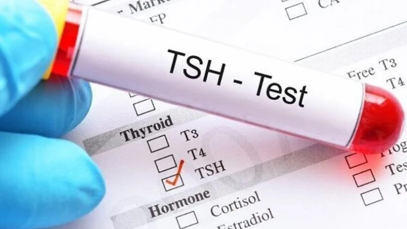 Chỉ số TSH phản ánh điều hòa tuyến giáp, người khỏe mạnh thường từ 0,4 đến 4,0 mU/L