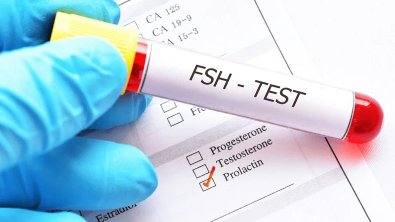 Xét nghiệm FSH là một trong các xét nghiệm hormone sinh dục được chỉ định phổ biến