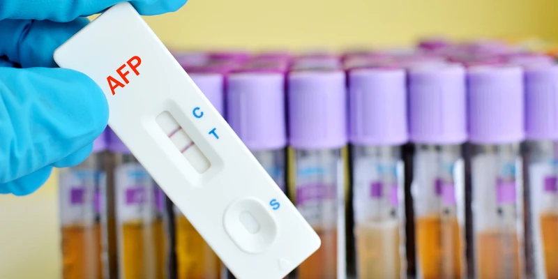 Xét nghiệm ung thư gan: Những điều bạn cần biết 2