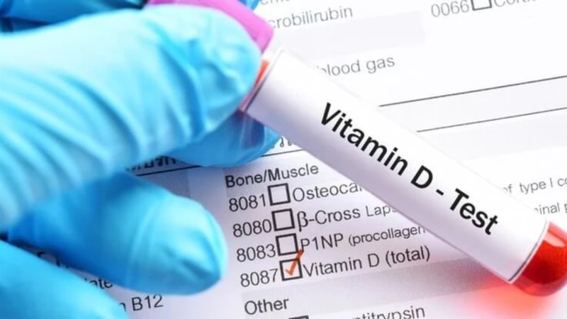 Xét nghiệm vitamin D giúp bác sĩ biết cơ thể đang thiếu, đủ hay dư, từ đó điều chỉnh chăm sóc sức khỏe phù hợp