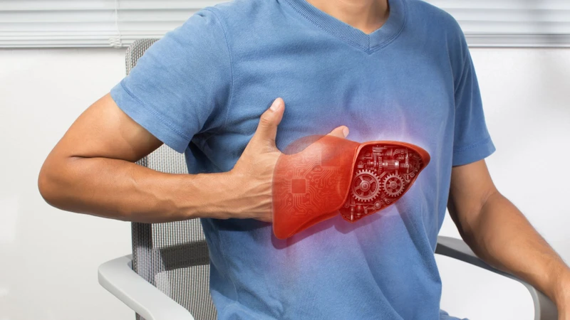 Xơ gan F4 là giai đoạn tổn thương gan nghiêm trọng