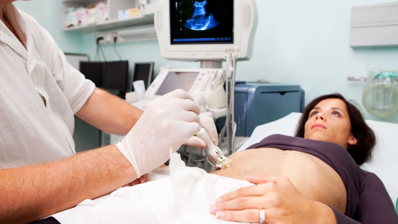 Xơ gan giai đoạn 2: Triệu chứng, chẩn đoán và phương pháp điều trị 3