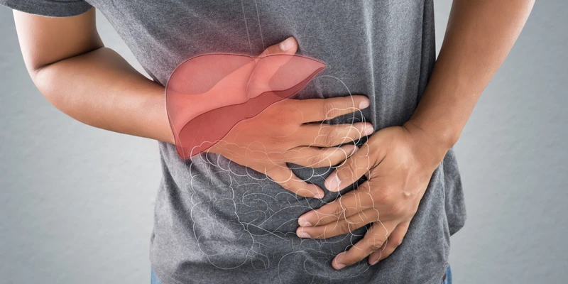 Xơ gan k74 có nguy hiểm không? Triệu chứng và cách điều trị 2