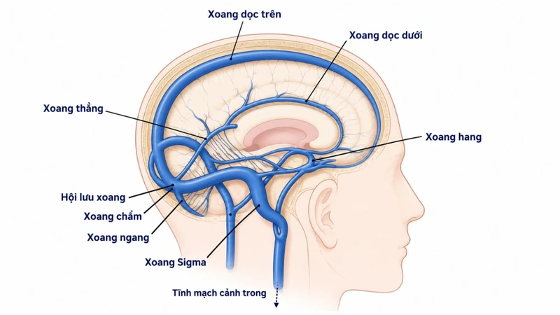 Xoang dọc, xoang ngang, xoang sigma và xoang hang là các xoang chính
