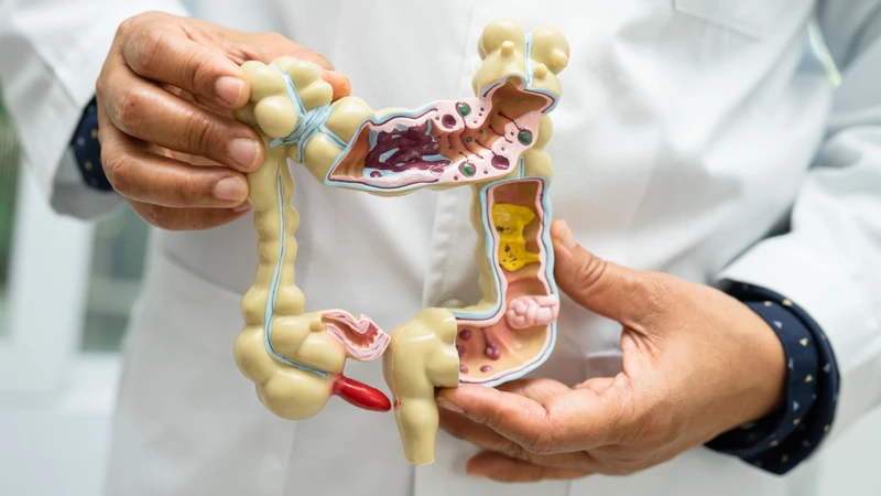 Xuất huyết tiêu hóa: Nguyên nhân, triệu chứng và phân loại 1