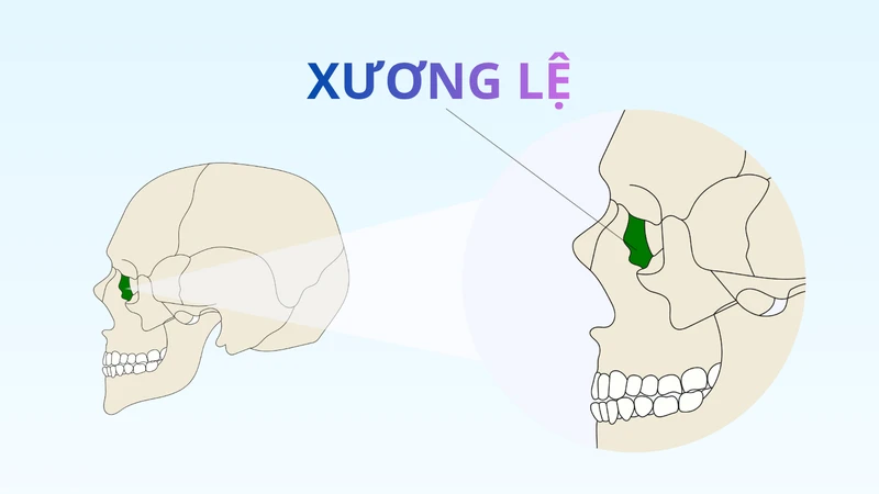 Xương lệ rất mỏng và gồm hai mặt chính