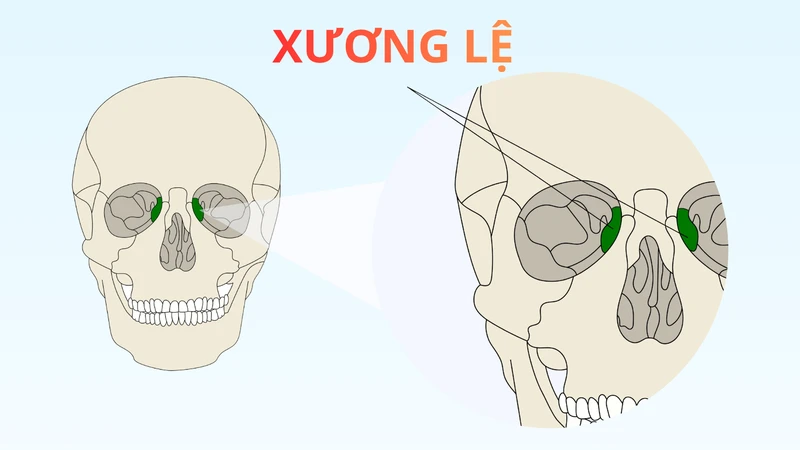 Xương lệ là một cặp xương rất nhỏ nằm ở thành trong hốc mắt, gần sống mũi