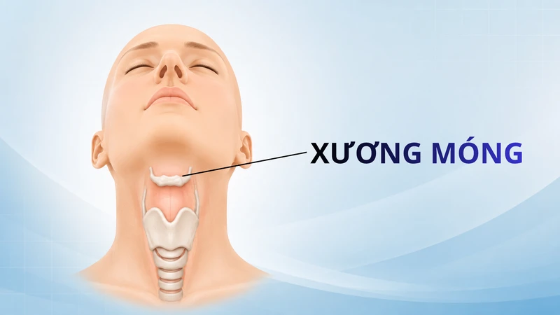 Xương móng là một xương nhỏ hình chữ U nằm ở vùng cổ trước