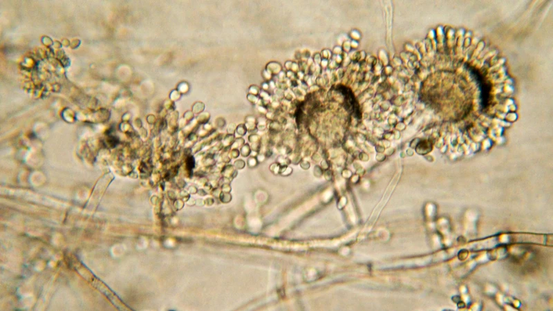 Nhiễm trùng do nấm Aspergillus - Dấu hiệu nhận biết và cách phòng ngừa2