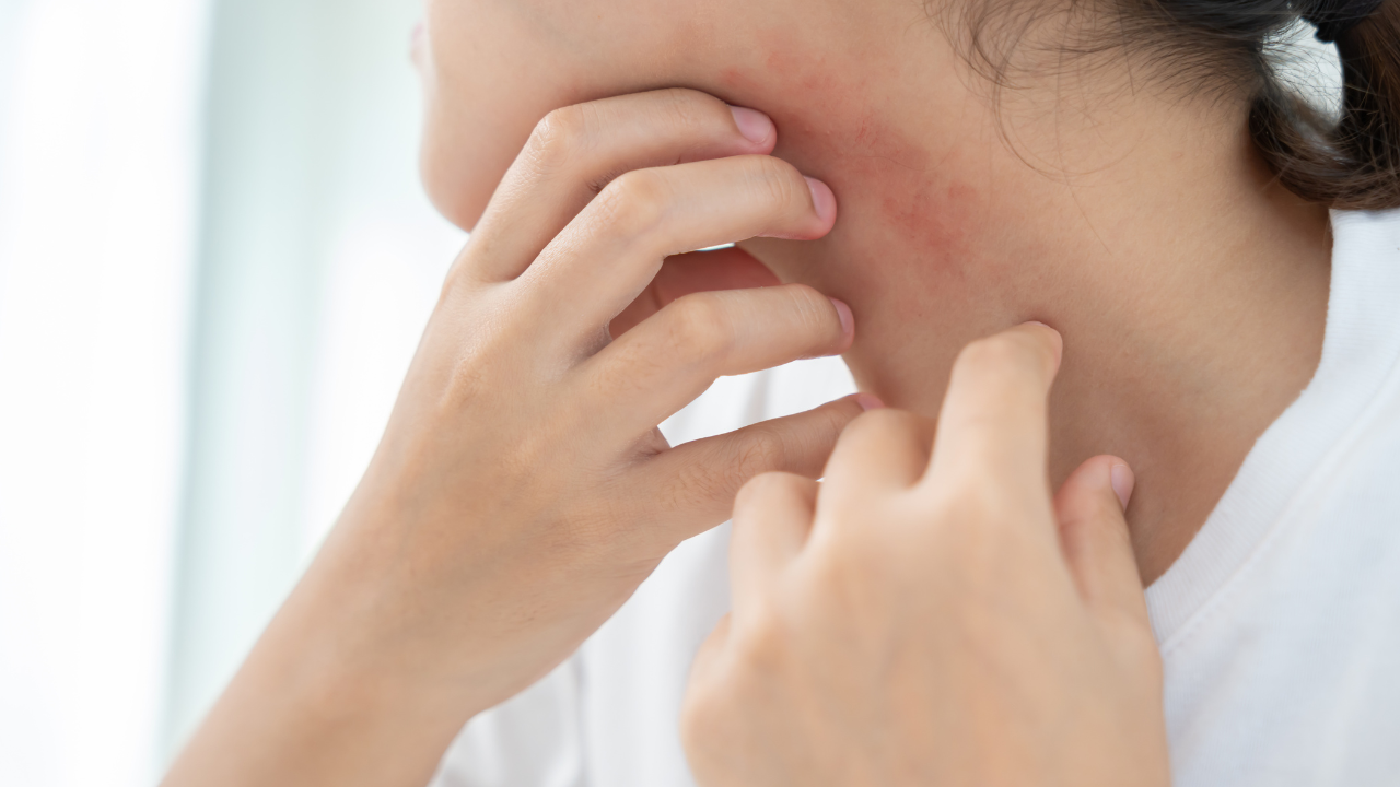 Uống collagen có tác dụng phụ gì không?