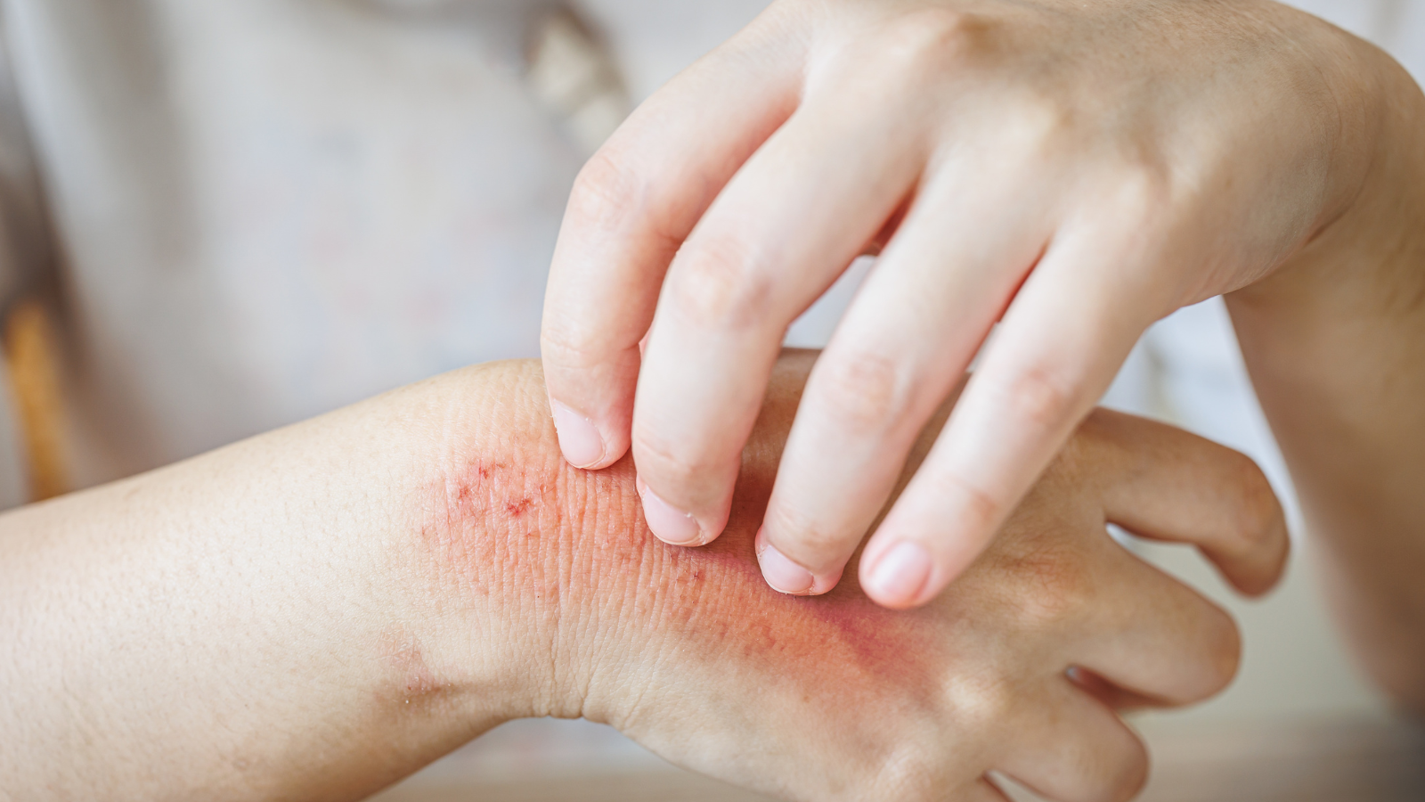 Lạm dụng kháng sinh gây rối loạn vi sinh và tăng nguy cơ kháng thuốc