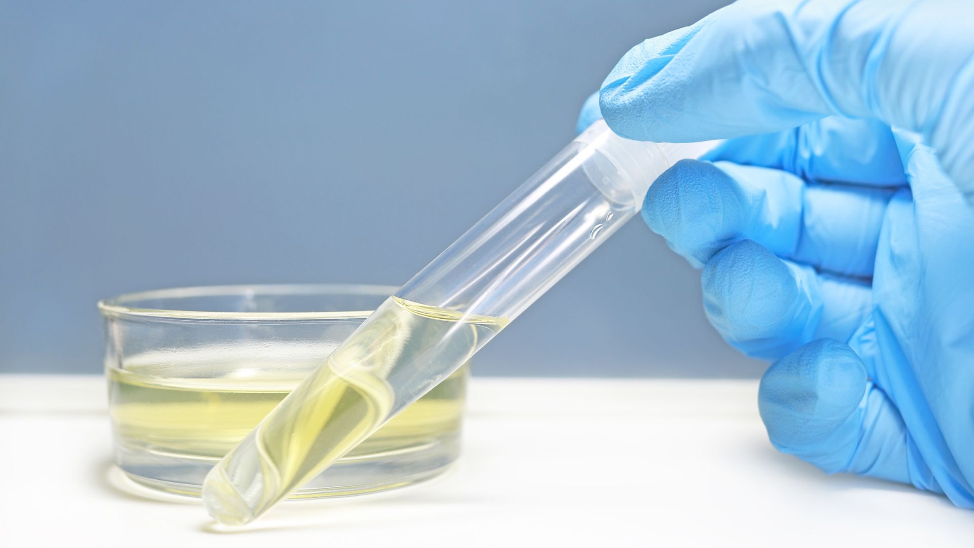 Nước tiểu trong hoặc có màu vàng nhạt được coi là bình thường khi đi tiểu nhiều