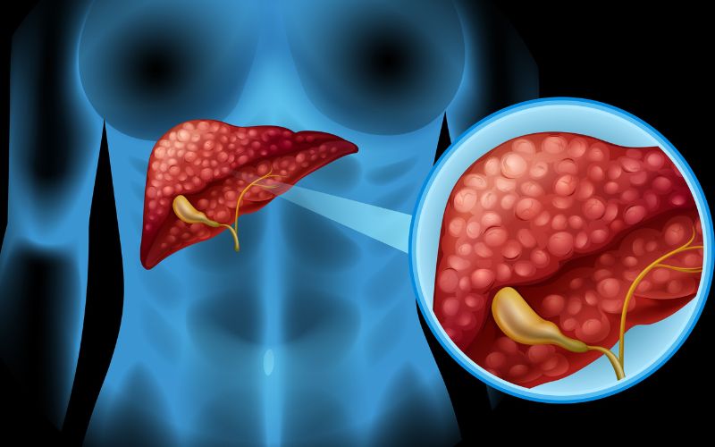Sử dụng thuốc hạ sốt quá liều có thể gây độc cho gan, thận