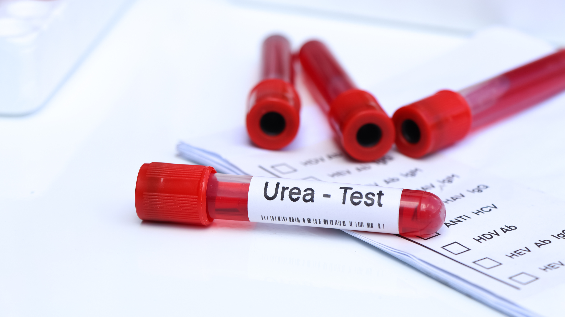 Ure máu tăng hoặc giảm đều có ý nghĩa, cần kết hợp thêm xét nghiệm để đánh giá chính xác