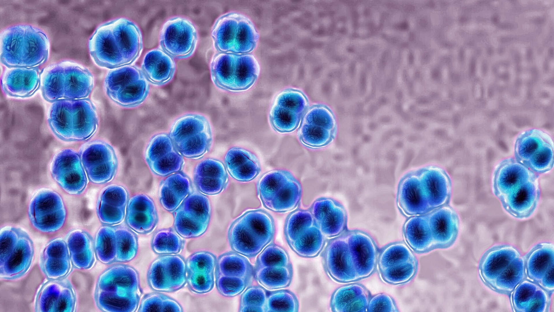 Haemophilus influenzae type B (Hib) là nguyên nhân chính gây viêm màng não cấp tính ở trẻ em